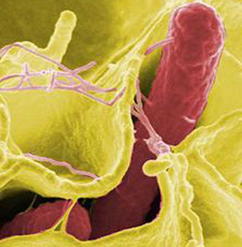 FDA aprueba PaxVax para fabricar contra el cólera