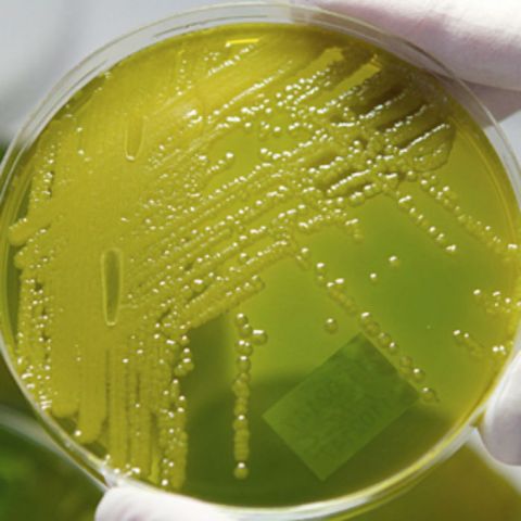 E.coli, la bacteria peligrosa