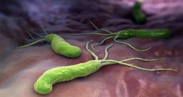 Helicobacter Pylori, infección silenciosa