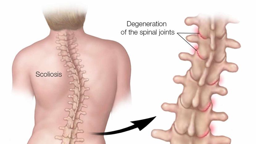 Verifica la columna vertebral de tu hijo