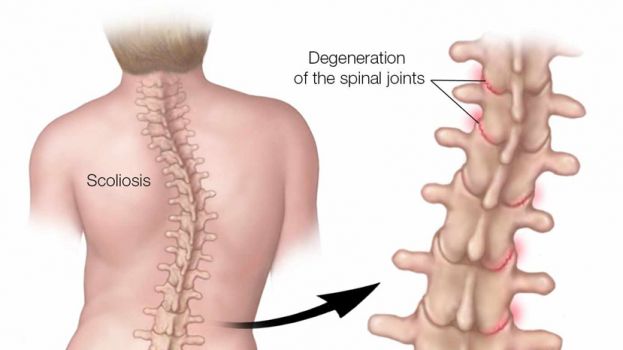 Verifica la columna vertebral de tu hijo